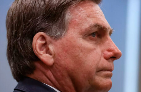 Presidente Bolsonaro é internado por obstrução intestinal, mas passa bem